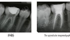 Περιστατικό #3