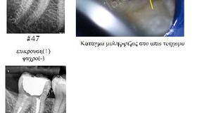 Περιστατικο #1